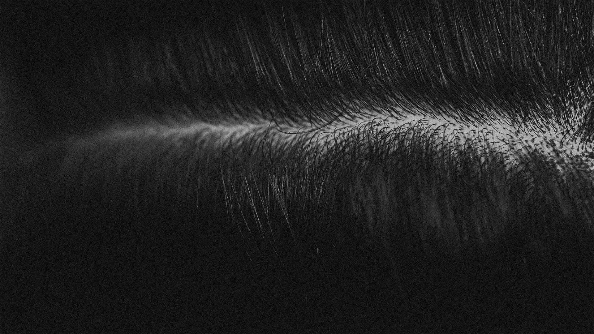 sem info microagulhamento capilar